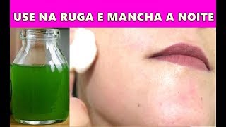 REMOVA 20 ANOS de RUGAS e MANCHAS - USANDO SOMENTE a NOITE!