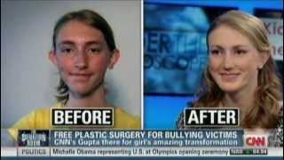 Free Plastic Surgery For Bullying Victim NADIA ILSE