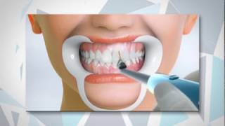 Tipos de diseño sonrisa