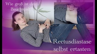 Rektusdiastase selbst ertasten