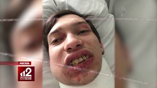 Студента жестоко избили в "Чайхоне"! Эксклюзив!