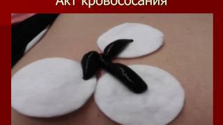 Урок 1 Домашний курс по гирудотерапии для всех