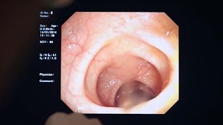 Looking Inside The Bowels | Should I Eat Meat? | BBC