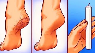 25 SIMPLE ABER GENIALE TRICKS FÜR DEN KÖRPER