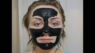 Чёрная маска- не помогает.