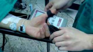 Como usar el TOF Watch (Monitor de Relajación Neuromuscular)