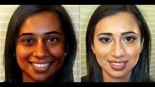 Glutathione skin whitening Treatment At Home/Glutone skin lightening cream and serum