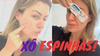 Como Cuidar De Cravos e Espinhas - Produtinhos para pele que uso no dia a dia