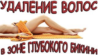 Удаление волос в зоне глубокого бикини в домашних условиях