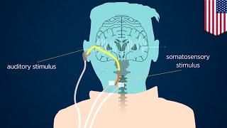 What is that ringing in my ears? Anti-tinnitus device drowns out brain with sound - TomoNews