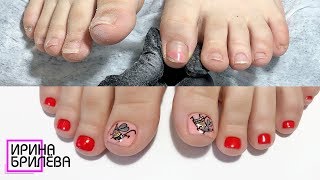 Обработка стоп и пальчиков Step дисками ? ПЕДИКЮР (Комбинированный)
