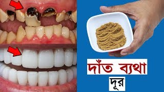 দাঁত ব্যাথা,দাঁতের রক্ত পরা ও কালো দাঁত ১ মিনিটে করে তুলুন মুক্তোর মতো সাদা~১০০% গ্যারান্টি সহ।