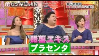 ホンマでっか! ＴＶ薄毛・育毛に効果抜群のプラセンタ・・・
