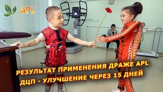 ► APLGO ✨ Результат применения продуктов APL при ДЦП до и через 15 дней! Отзывы APL GO.