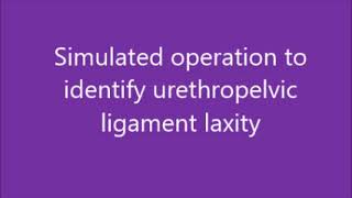 Simulated operation to identify urethropelvic ligament laxity