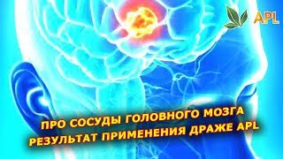 ► APLGO ✨ Про сосуды головного мозга. Эффективность применения драже APL. Отзывы APL.