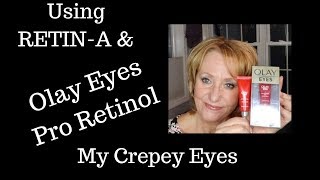 Retin-A | Olay Pro-Retinol Eye Cream On My Mature Crepey Eyes  | Sixty Plus