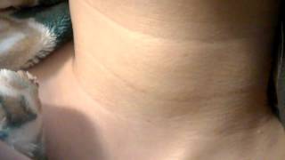 Visible Female Neck Pulse (No sound)