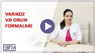 Ayaqda varikoz. Varikoz və onun formaları.