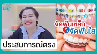 จัดฟันมีกี่แบบ จัดแบบไหนดี ติดเหล็ก vs จัดฟันใส Invisalign
