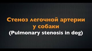 Стеноз Клапана Легочной Артерии