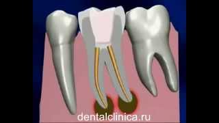 Лечение зубов красивая улыбка протезирование имплантация European Clinic of Aesthetic Dentistry