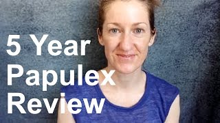 Papulex Review / Update: 2018 Edition