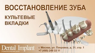 ВОССТАНОВЛЕНИЕ ЗУБА | Культевые вкладки