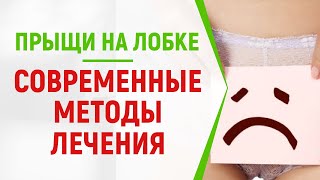 Прыщи на лобке: ТОП методов лечения