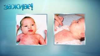 Болезни грудничков, которые не нужно лечить – За живе! Сезон 3. Выпуск 53 от 28.11.16
