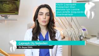 Çapraşık Diş Tedavileri - Dt. Beyza Ünal