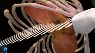 3D-пособие: Ультразвуковое исследование желчного пузыря -- ультразвуковая система SonoSite