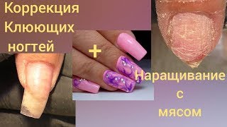 МАНИКЮР НА ИЮНЬ 2018 | ЛЕТНИЙ МАНИКЮР 2018 | ДИЗАЙН НОГТЕЙ ГЕЛЬ ЛАКОМ | КОРРЕКЦИЯ КЛЮЮЩИХ НОГТЕЙ