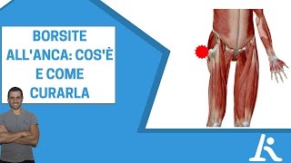 Borsite trocanterica: cos'è e come si cura