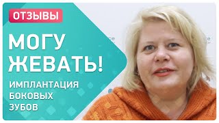 Имплантация жевательных зубов – отзыв пациента Smile-at-Once