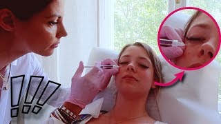 Augenringe unterspritzen lassen? ICH HABE ES GETAN !!!