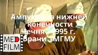 Ампутация нижней конечности. Чечня-1995. Врачи ММА © Amputation of lower limb. Chechnya-1995