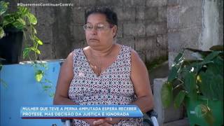 Mulher que teve perna amputada ainda aguarda prótese da prefeitura