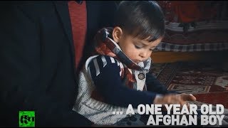 Meet Donald Trump… 1yo Afghan boy