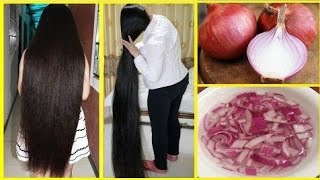 How to use onion juice for Hair Regrowth /Hair fall control /Dandruff ,Premature Greying of Hair.