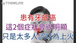 患有牙齦癌，這2個症狀會很明顯，只是太多人誤以為上火