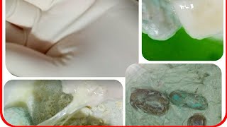 ASMR operation sodden soap? /АСМР операция размокшее мыло?