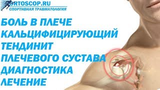 КАЛЬЦИФИЦИРУЮЩИЙ ТЕНДИНИТ ПЛЕЧЕВОГО СУСТАВА