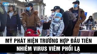 Mỹ phát hiện trường hợp đầu tiên nhiễm virus viêm phổi lạ