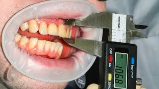 9 БЕЗУМНЫХ СПОСОБОВ УДАЛЕНИЯ ЗУБОВ