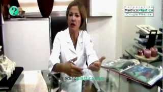 Preguntas frecuentes sobre la rinoplastia
