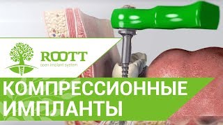 Пример операции с применением компрессионного имплантата, системы имплантации ROOTT (рут, root ).