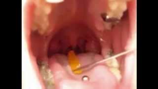 girl sexy gummy swallow and gulp whole
