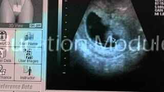 MedSim Ultrasound simulator - Симулятора для обучения УЗИ Ультрасим