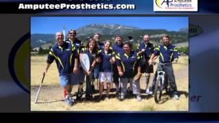 Artificial Limbs Washoe Valley NV   Amputee Prosthetics